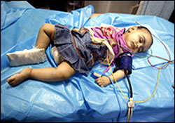 کودک لیبیایی زخمی شده 