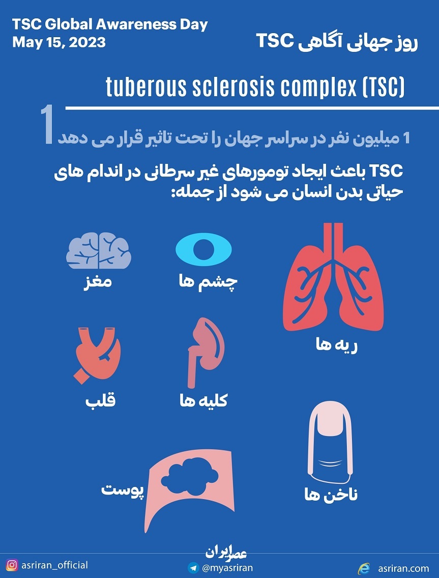 15 می، روز جهانی آگاهی (اینفوگرافیک)